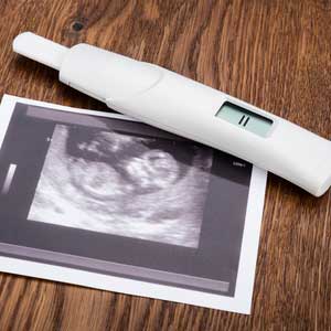 Morgenurin schwangerschaftstest Schwangerschaftstest: Morgenurin