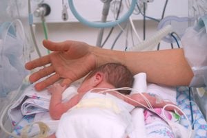 frühgeborenes Baby im Brutkasten