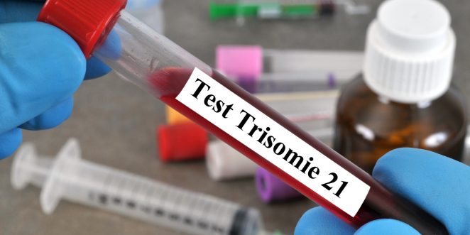 Bluttest Trisomie 21