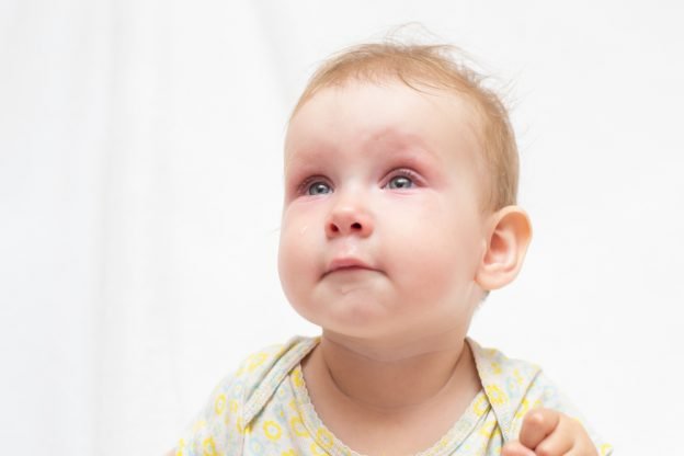 Was tun bei einer Bindehautentzündung bei ihrem Baby?
