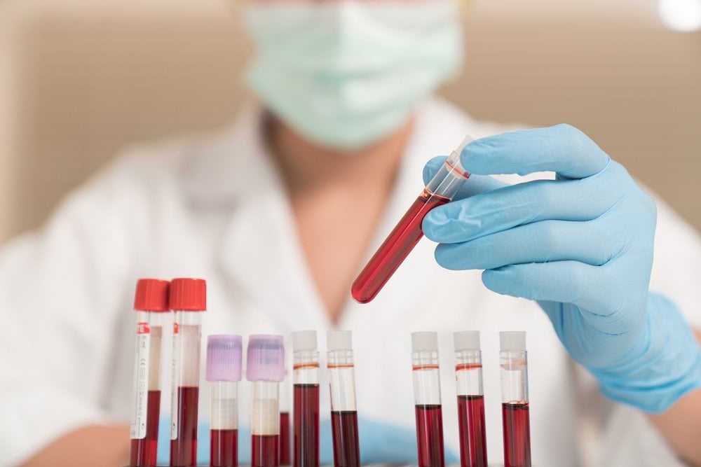 Ein Blutbild machen lassen Das müssen Sie beachten