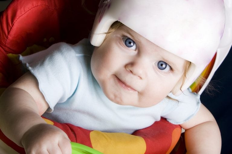 Helmtherapie für Babys Informationen zur Kopforthese für Kinder