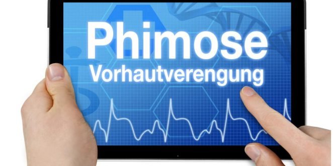 Phimose Phimosis in